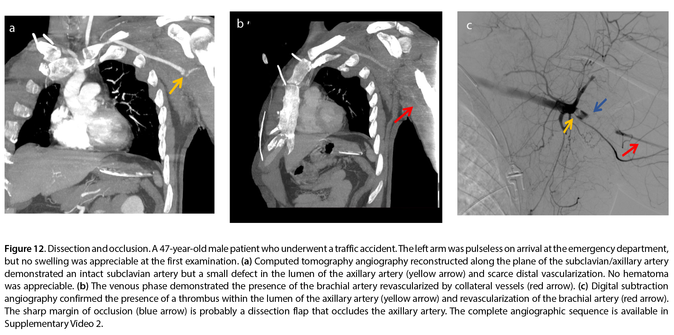 Figure 12