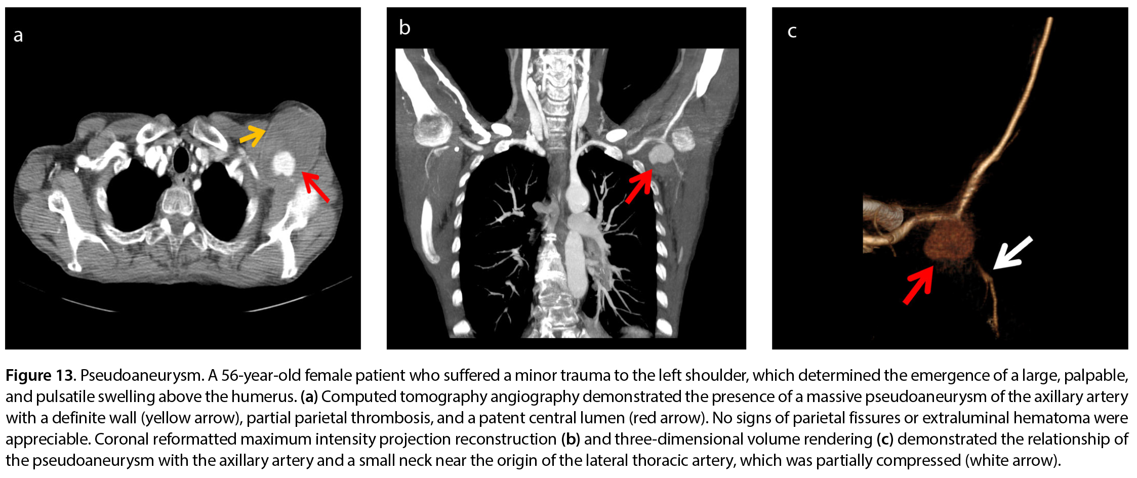 Figure 13