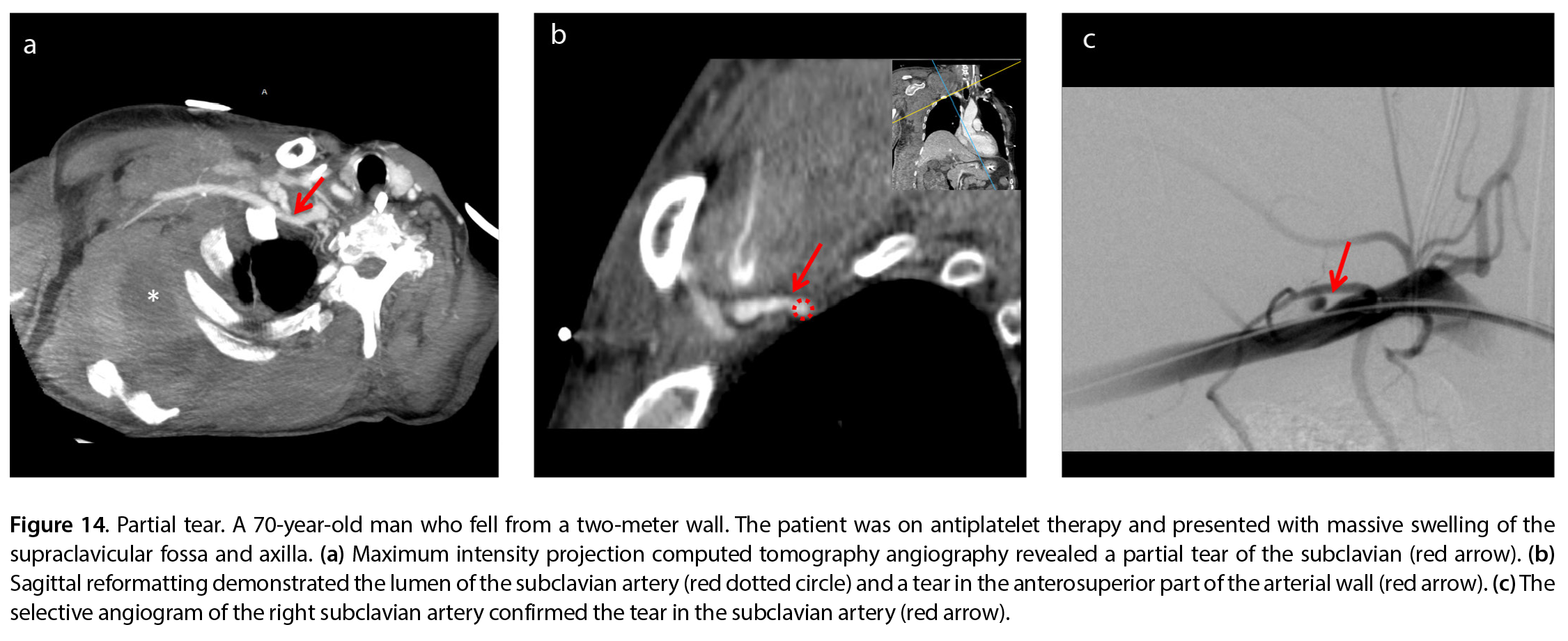 Figure 14