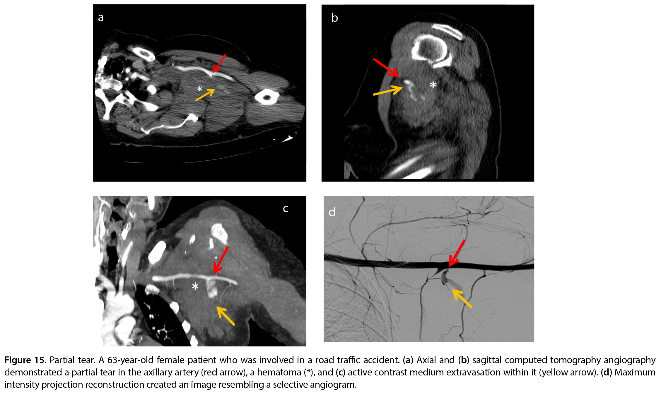 Figure 15