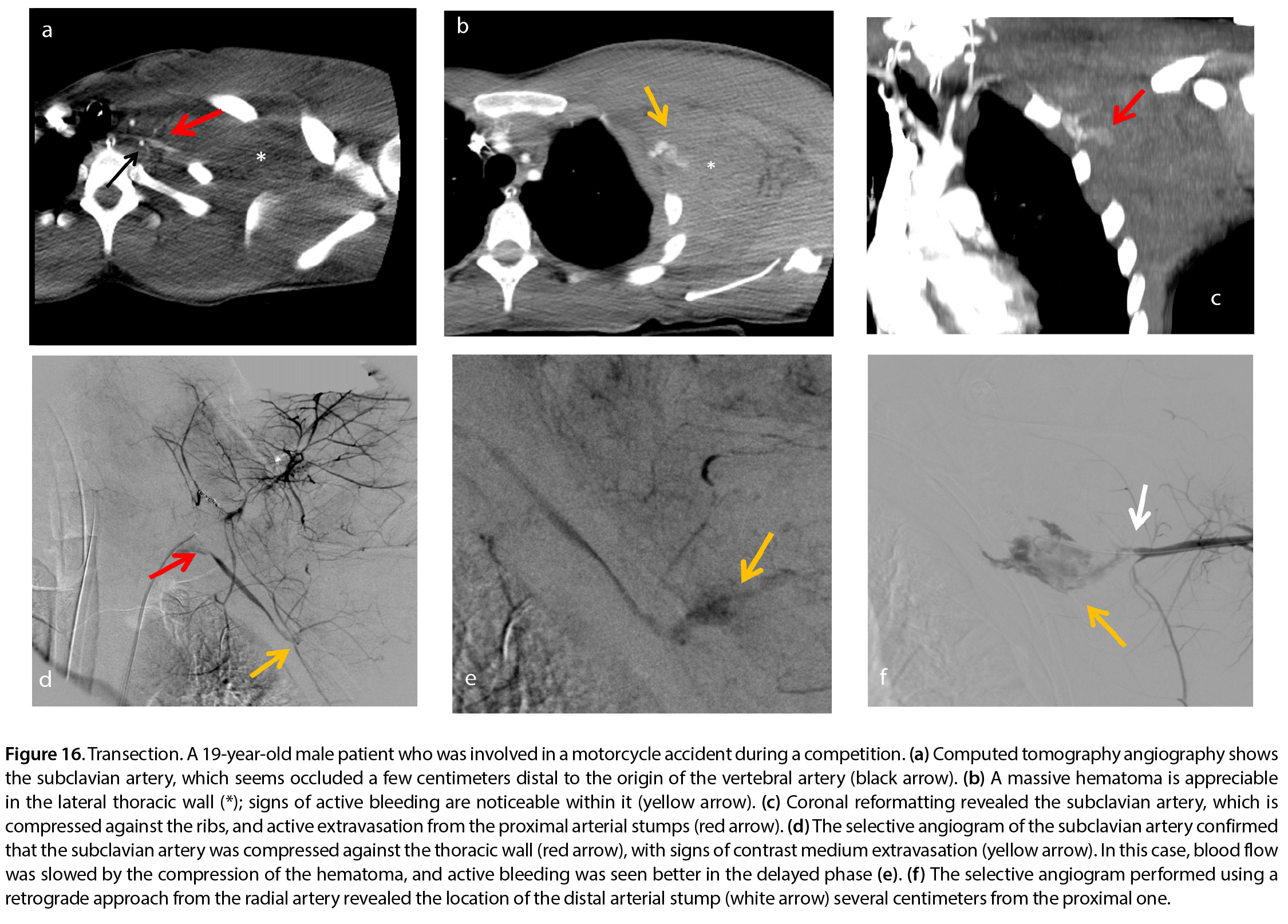Figure 16