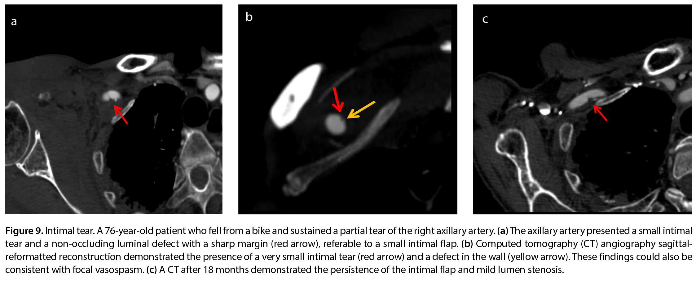 Figure 9