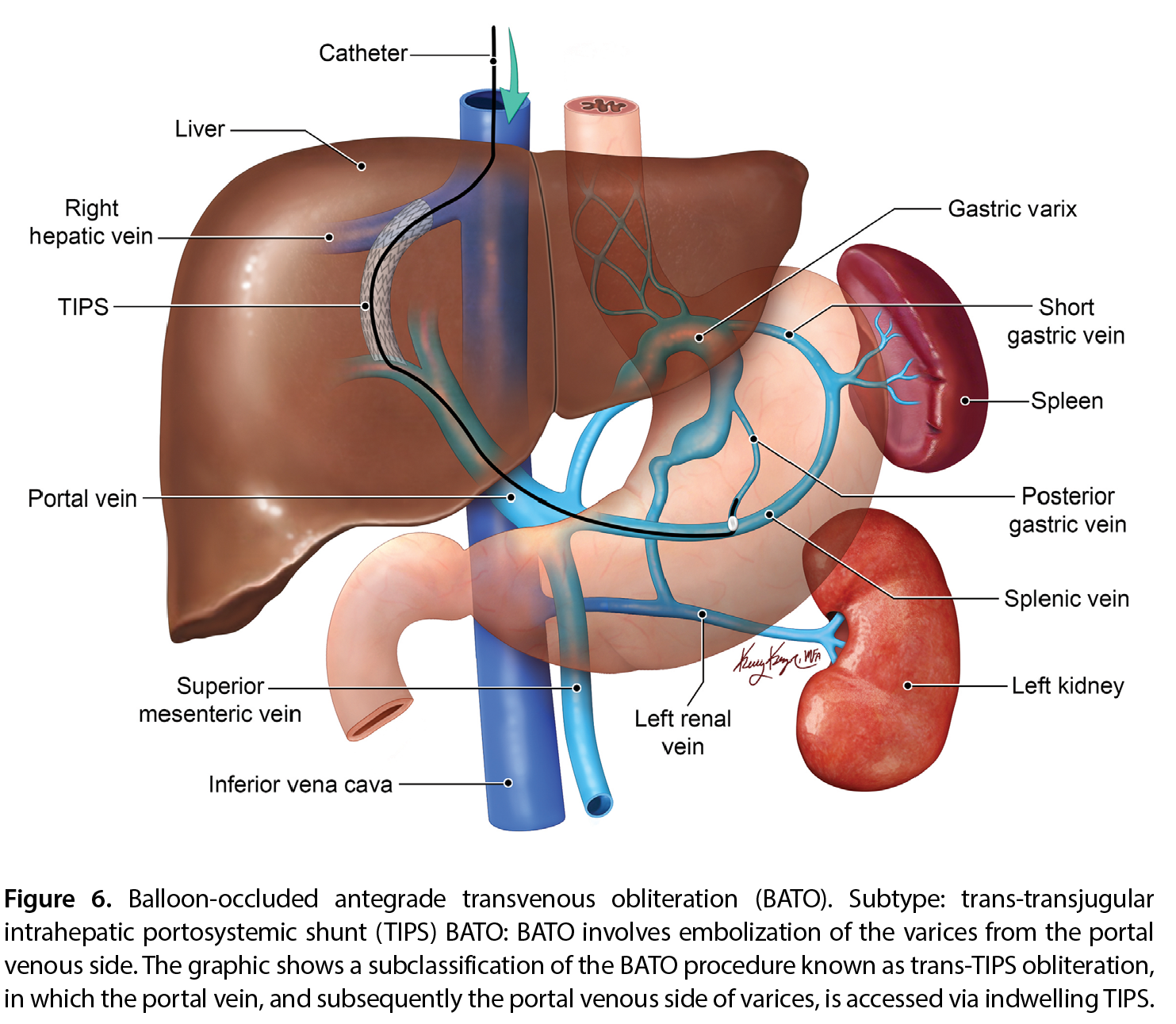 Figure 6