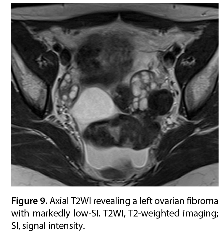 Figure 9