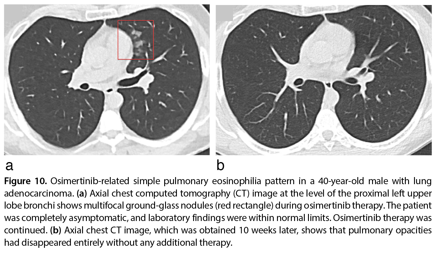 Figure 10