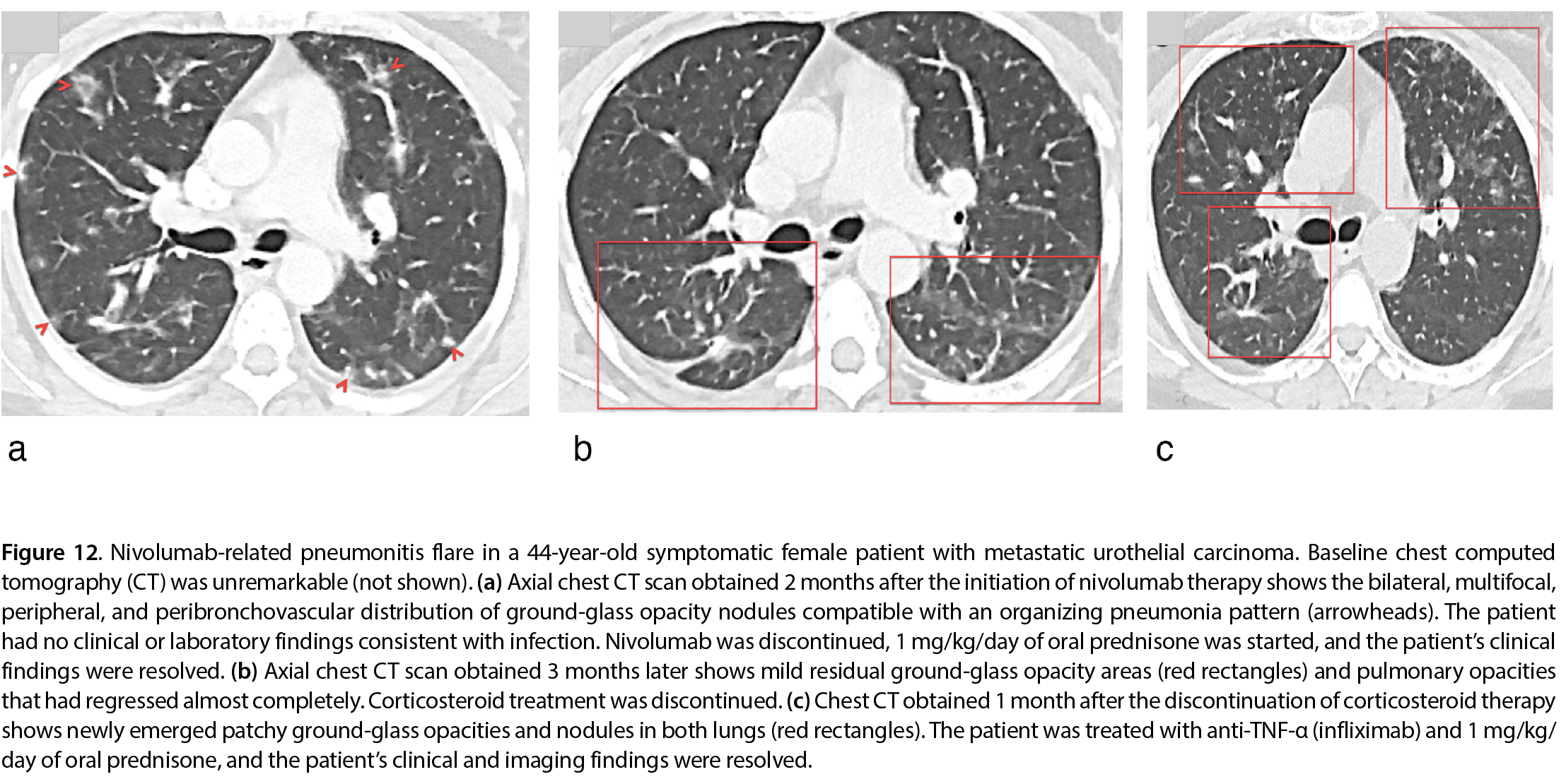 Figure 12