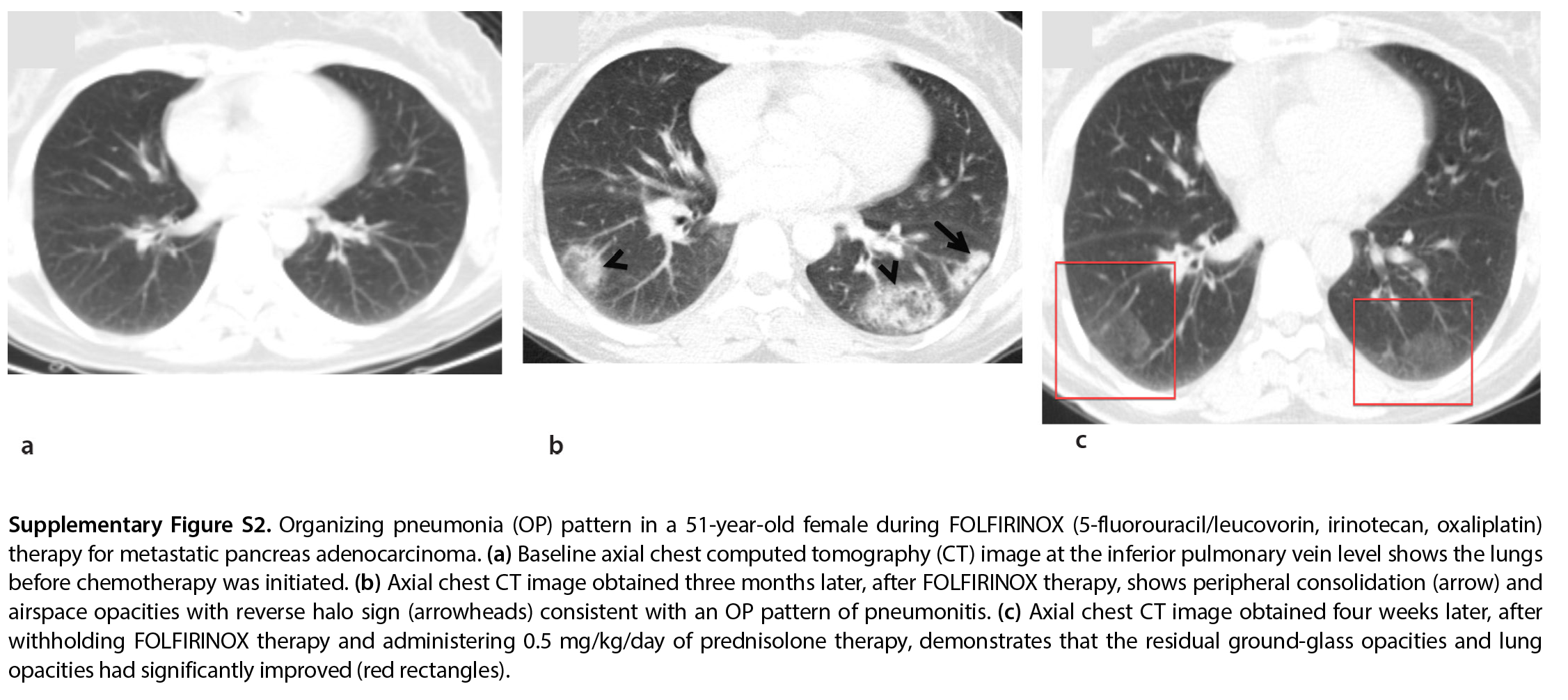 Supplementary Figure 2