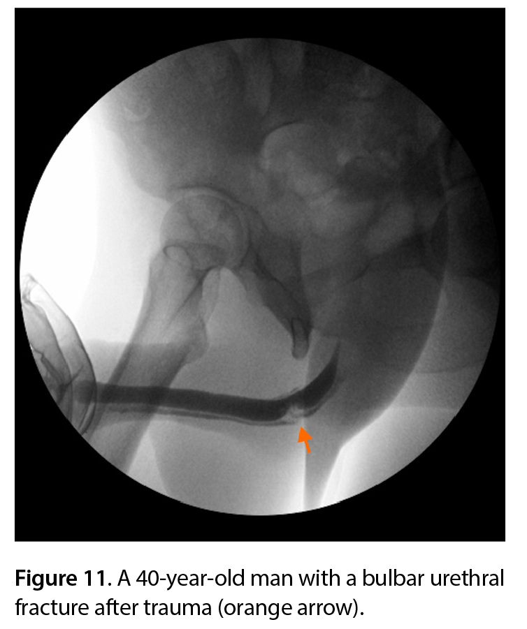 Figure 11