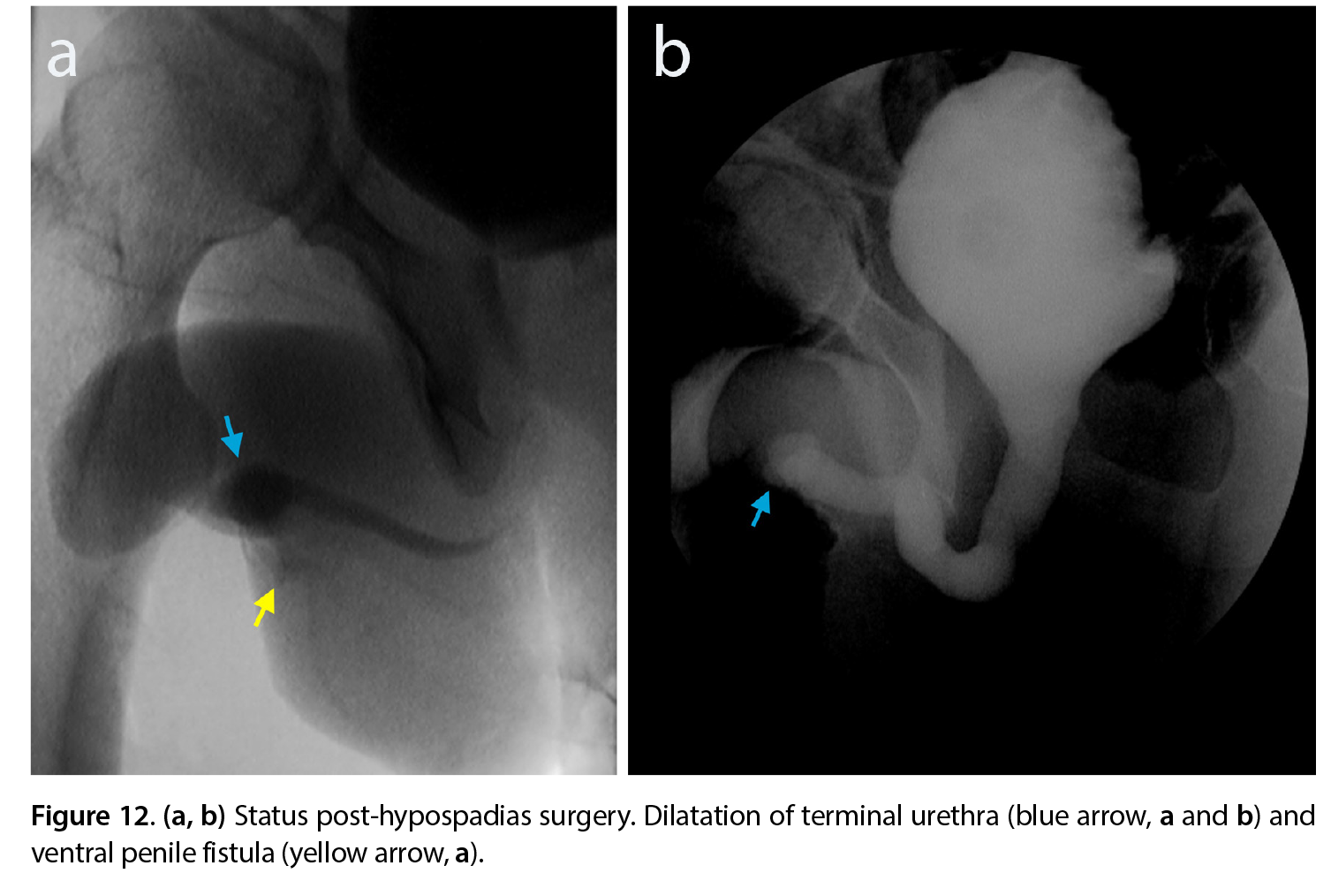 Figure 12
