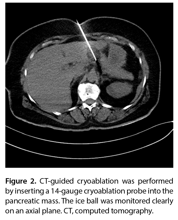 Figure 2