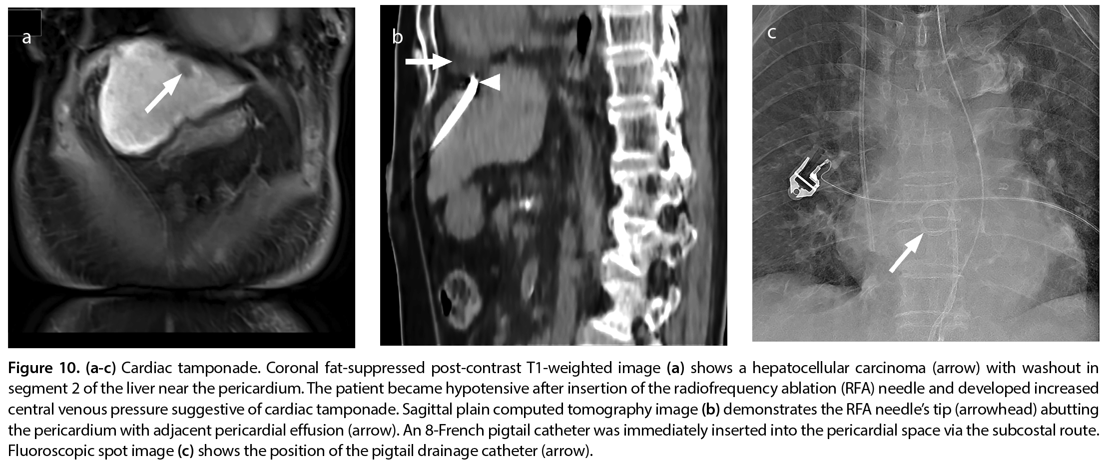 Figure 10