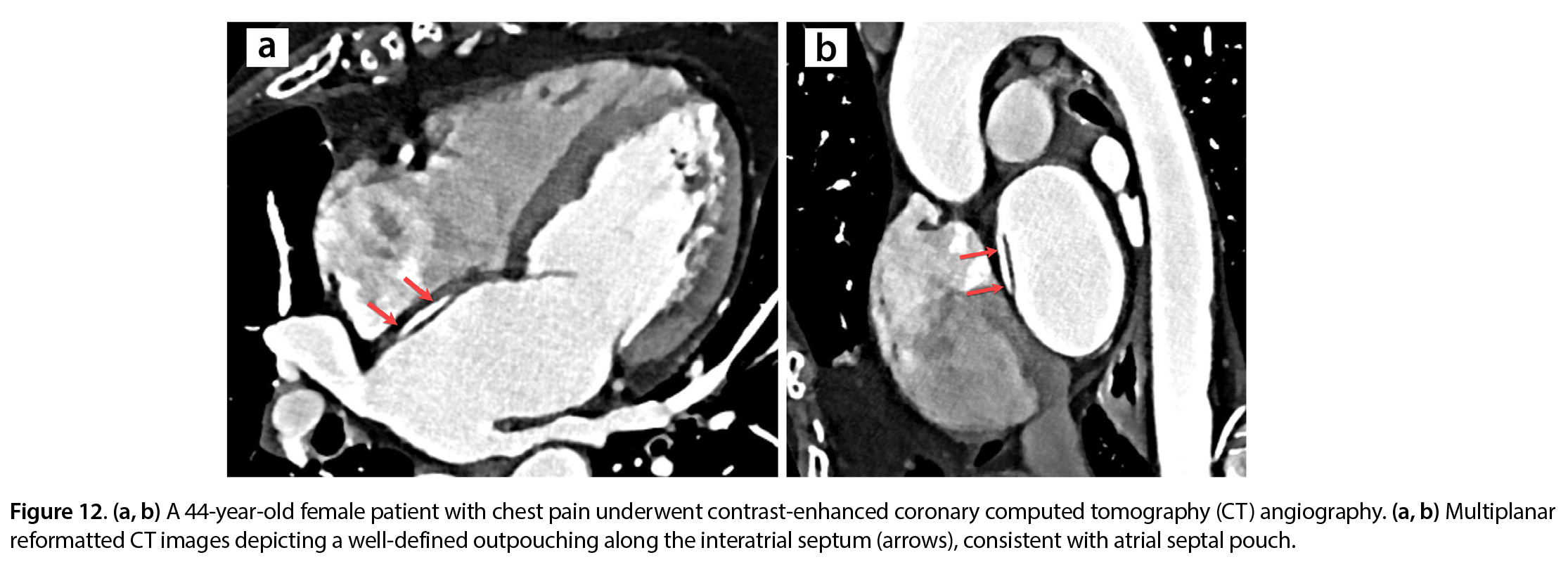 Figure 12