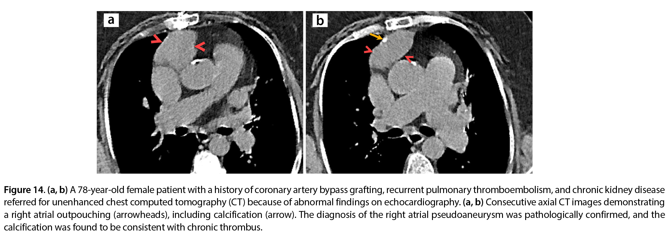 Figure 14