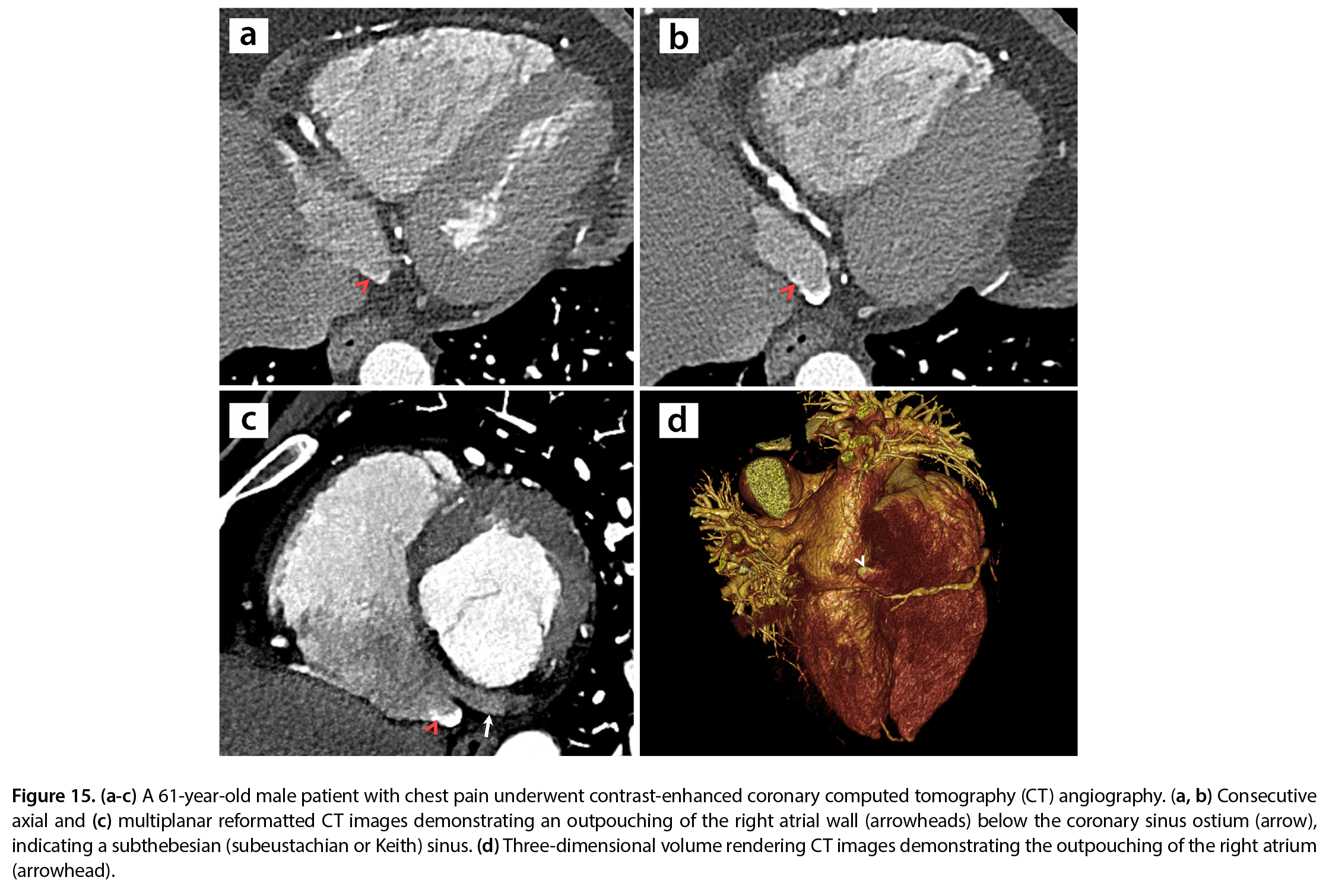 Figure 15