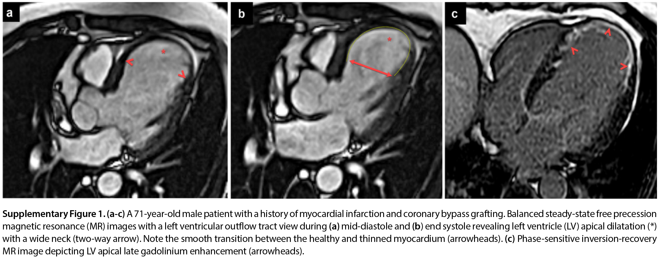 Supplementary Figure 1
