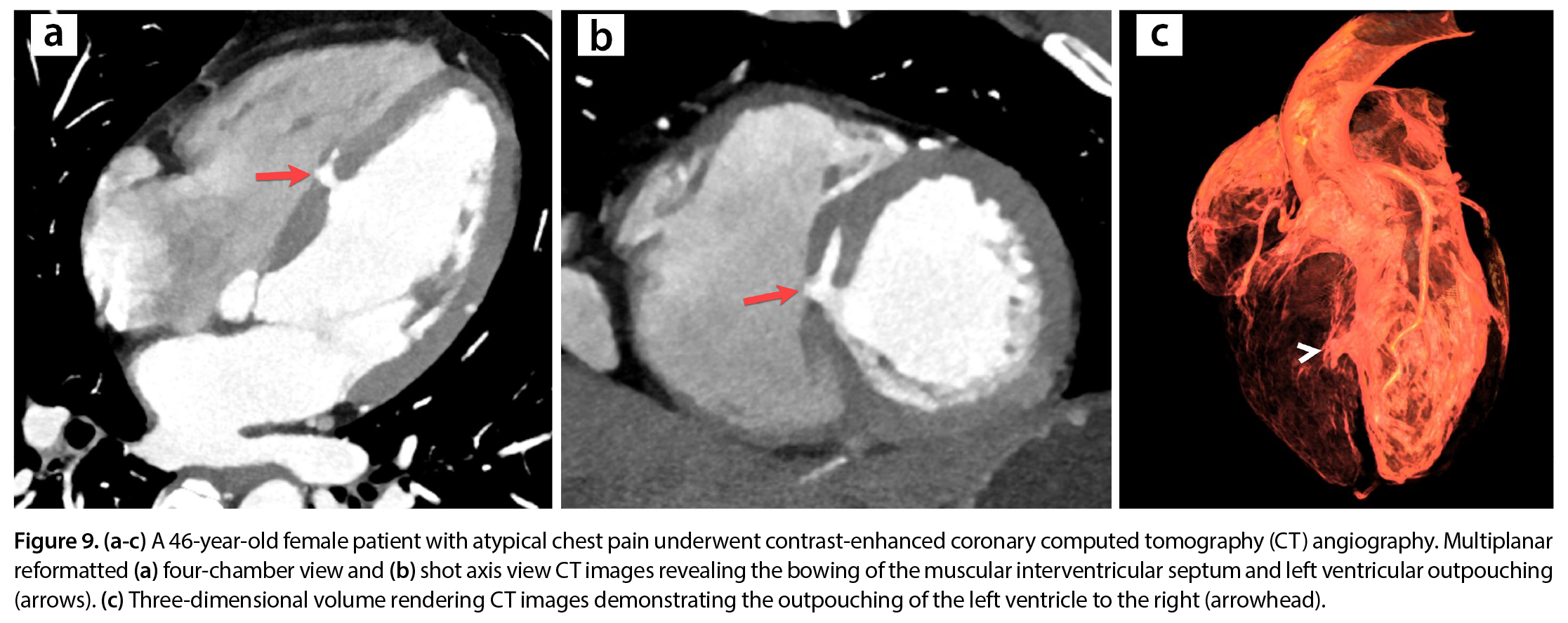 Figure 9