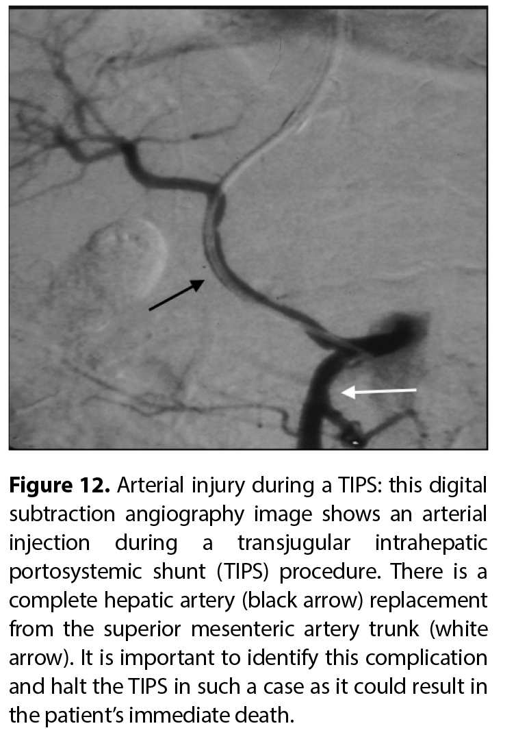 Figure 12