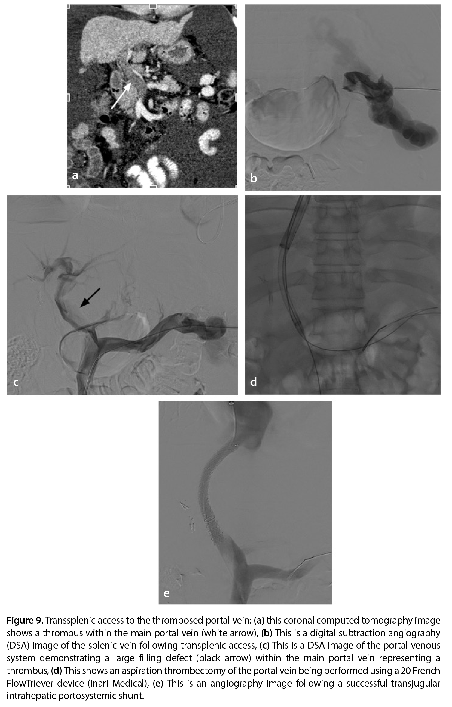 Figure 9