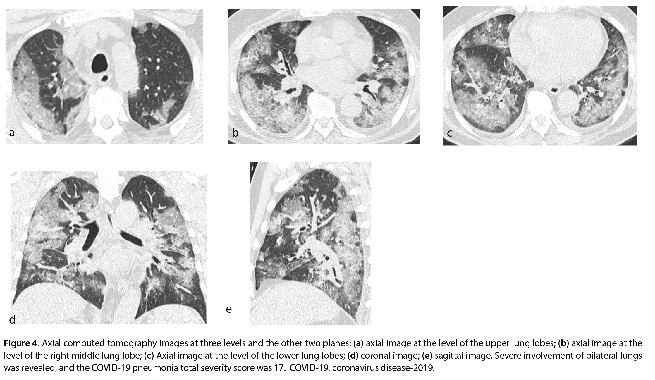 Figure 4