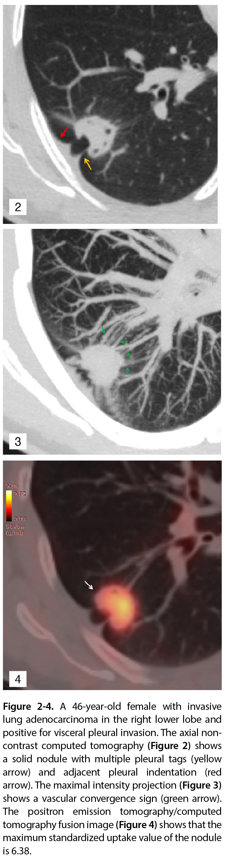 Figure 2-4