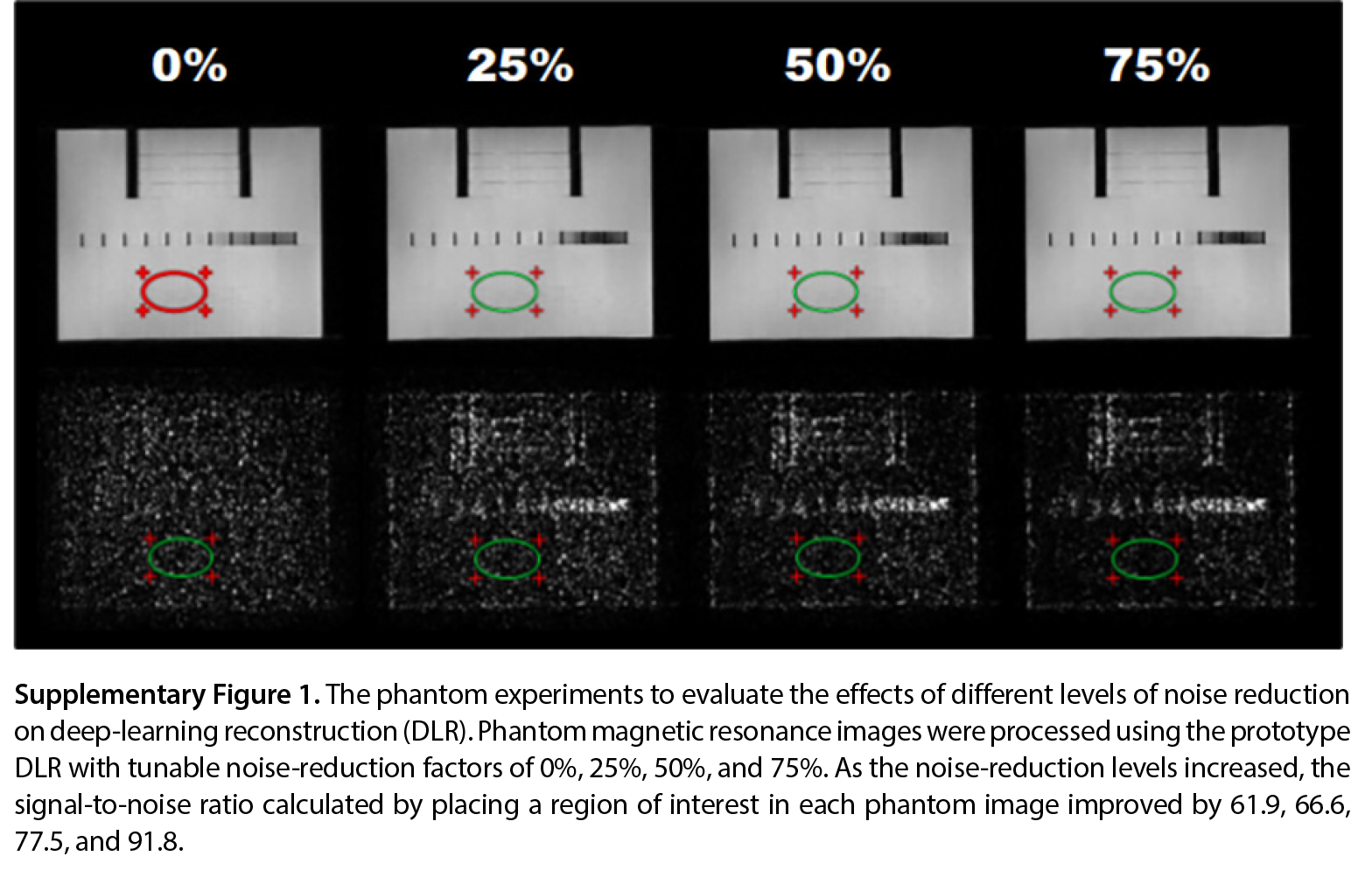 Supplementary Figure 1