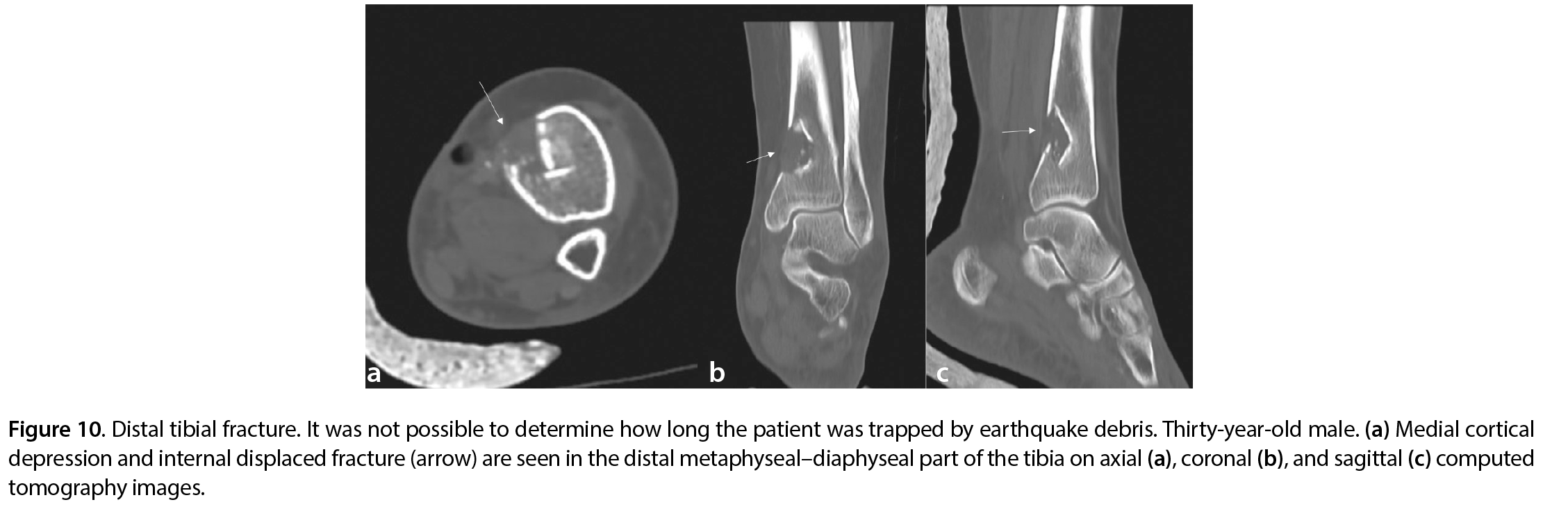 Figure 10