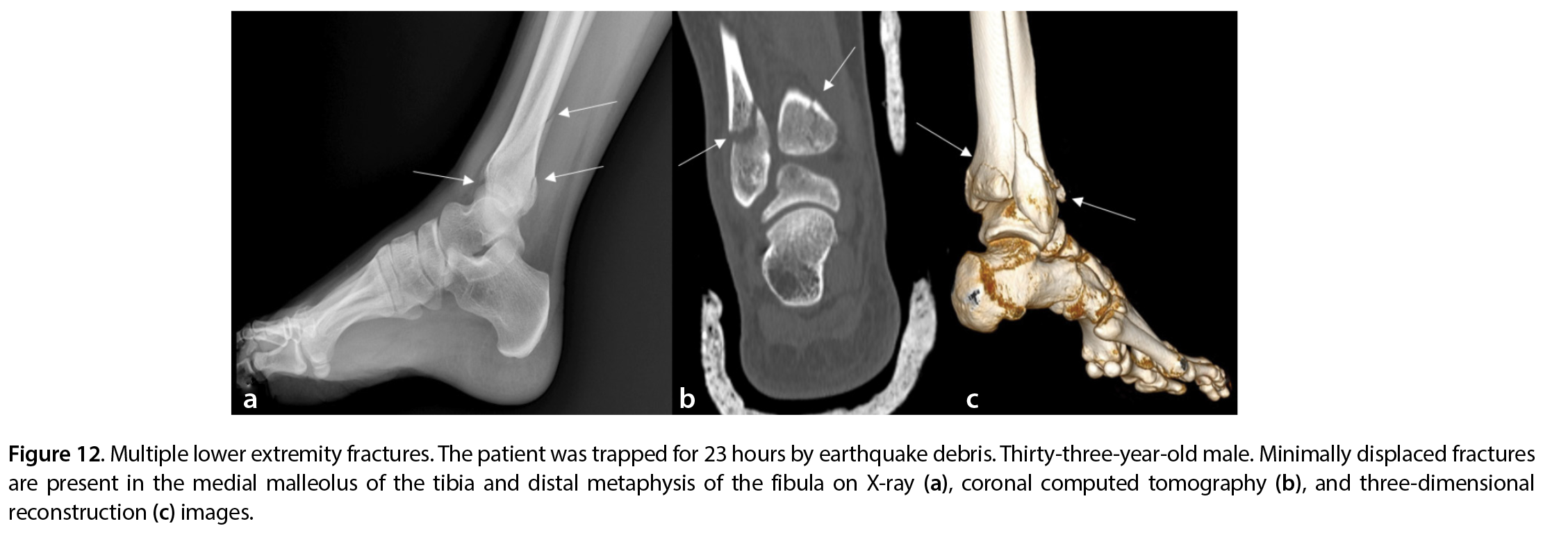Figure 12