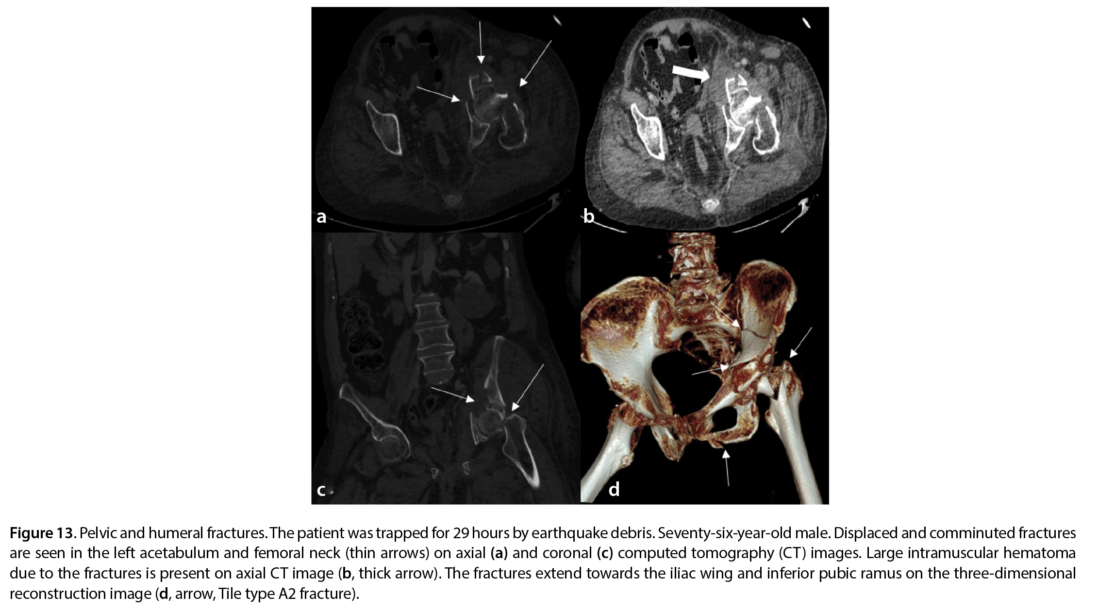 Figure 13