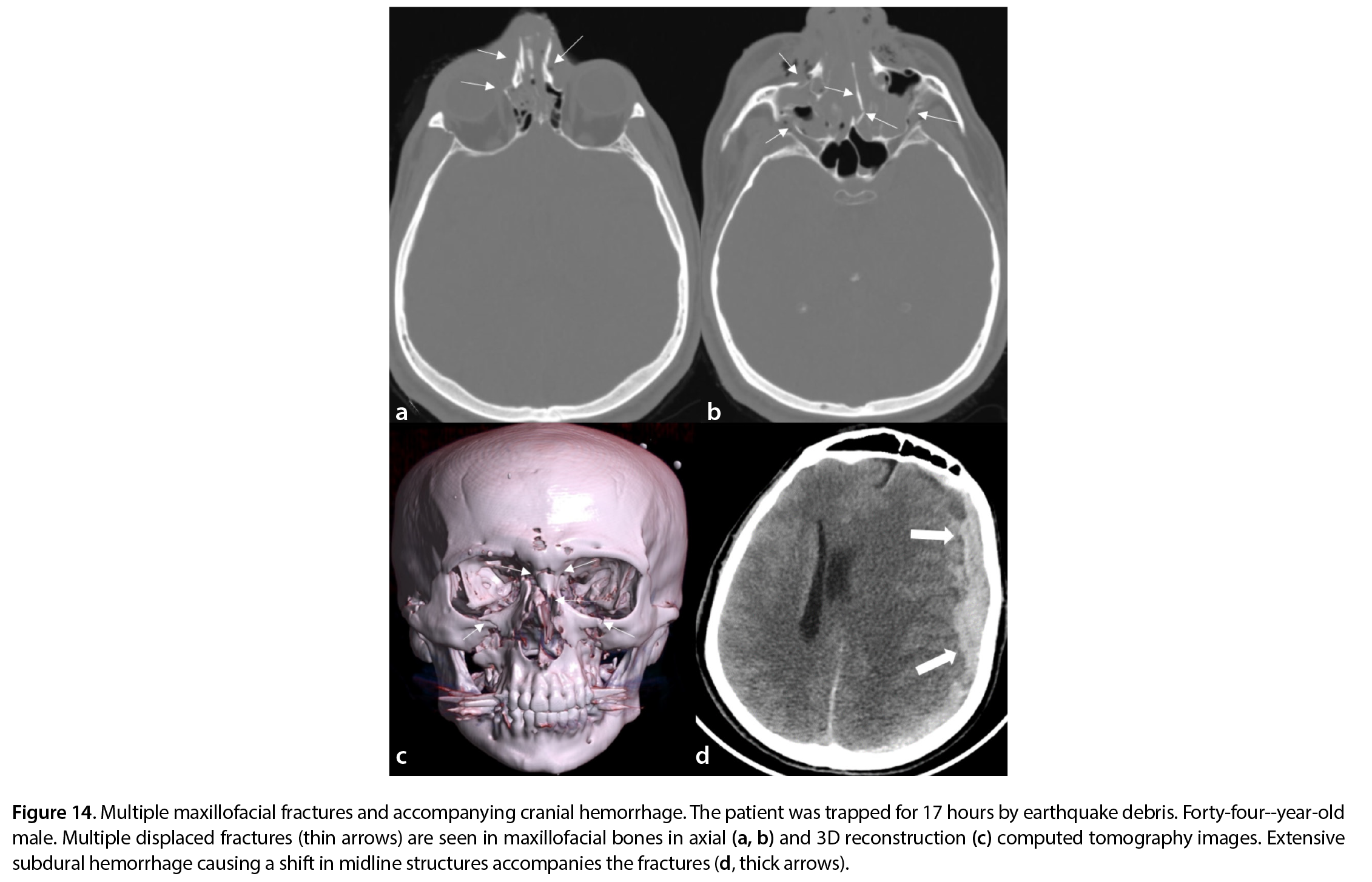 Figure 14