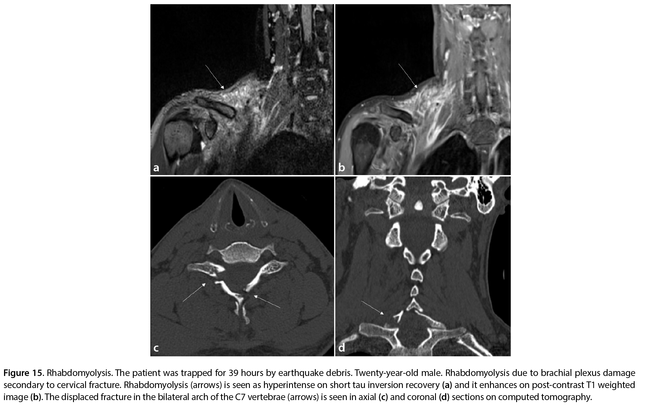 Figure 15