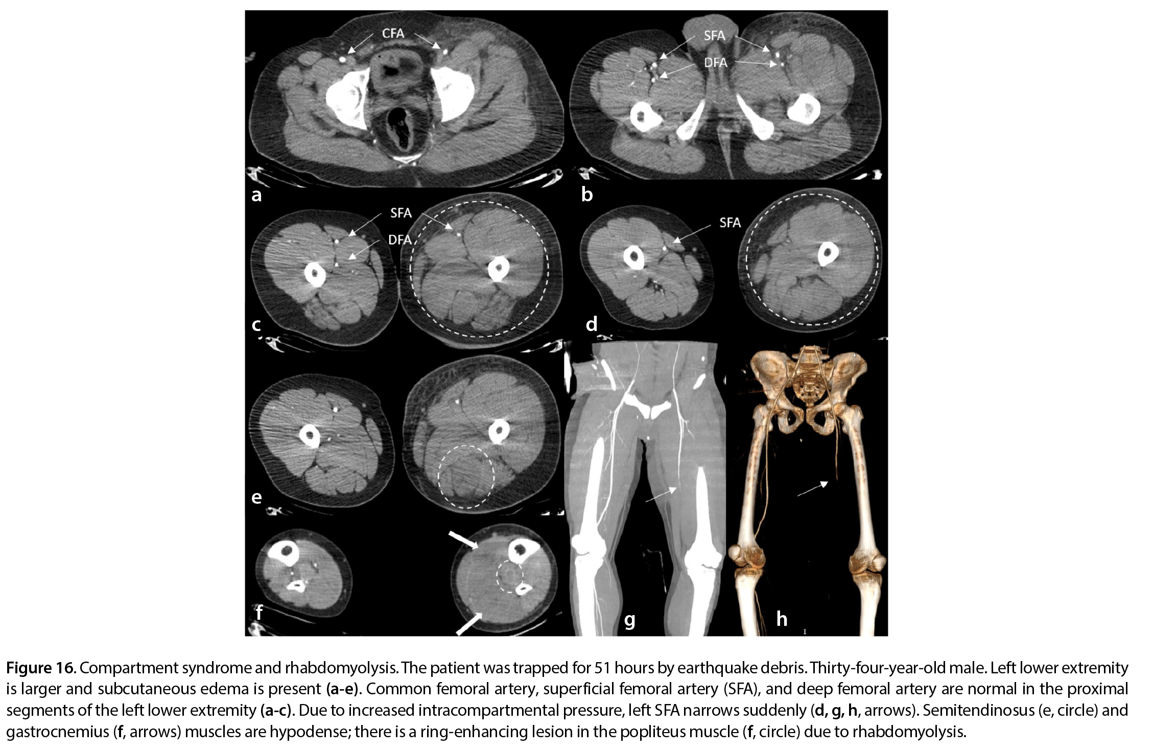 Figure 16