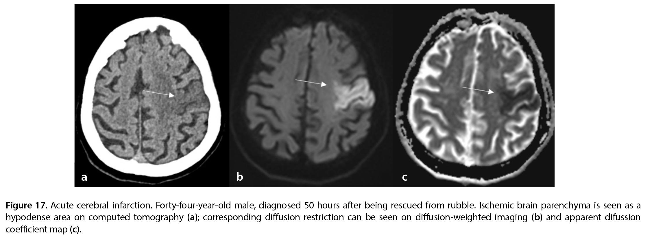 Figure 17