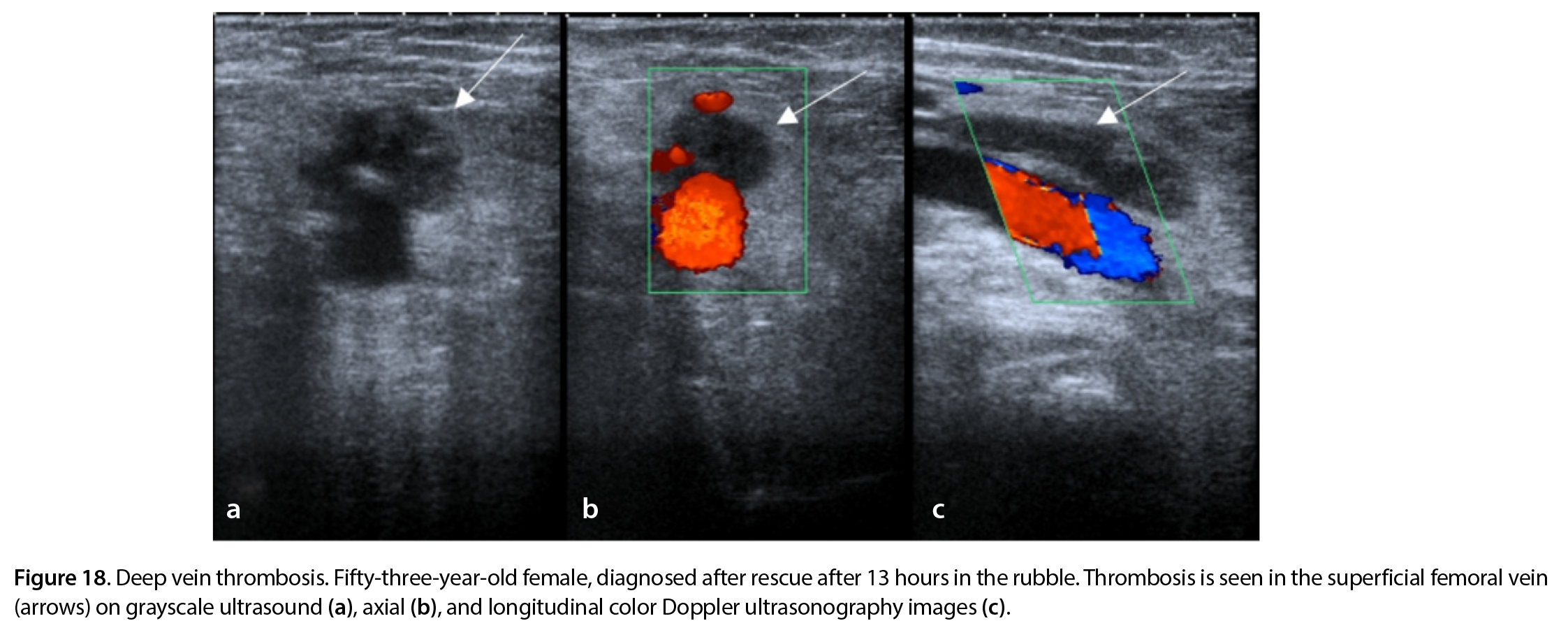 Figure 18