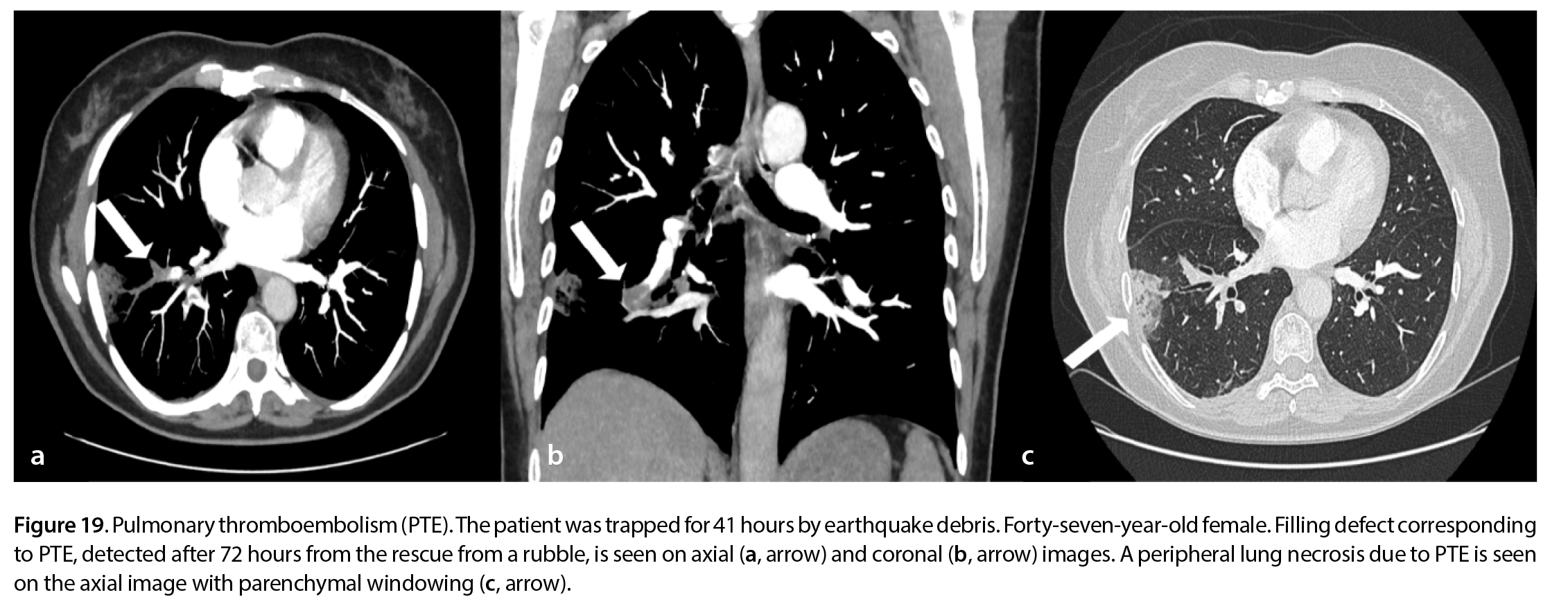 Figure 19