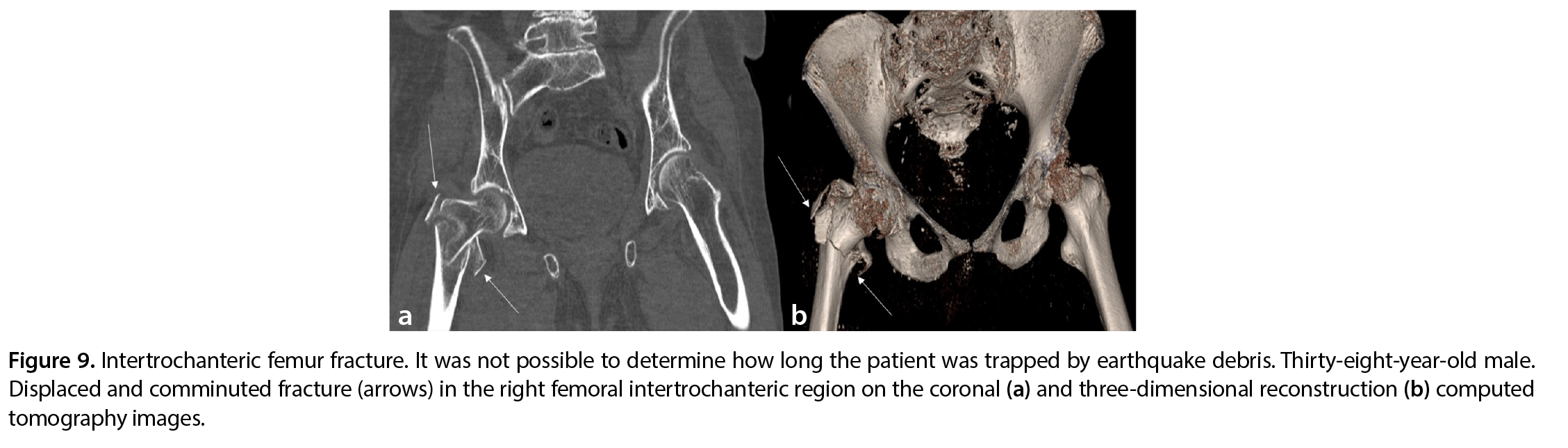 Figure 9