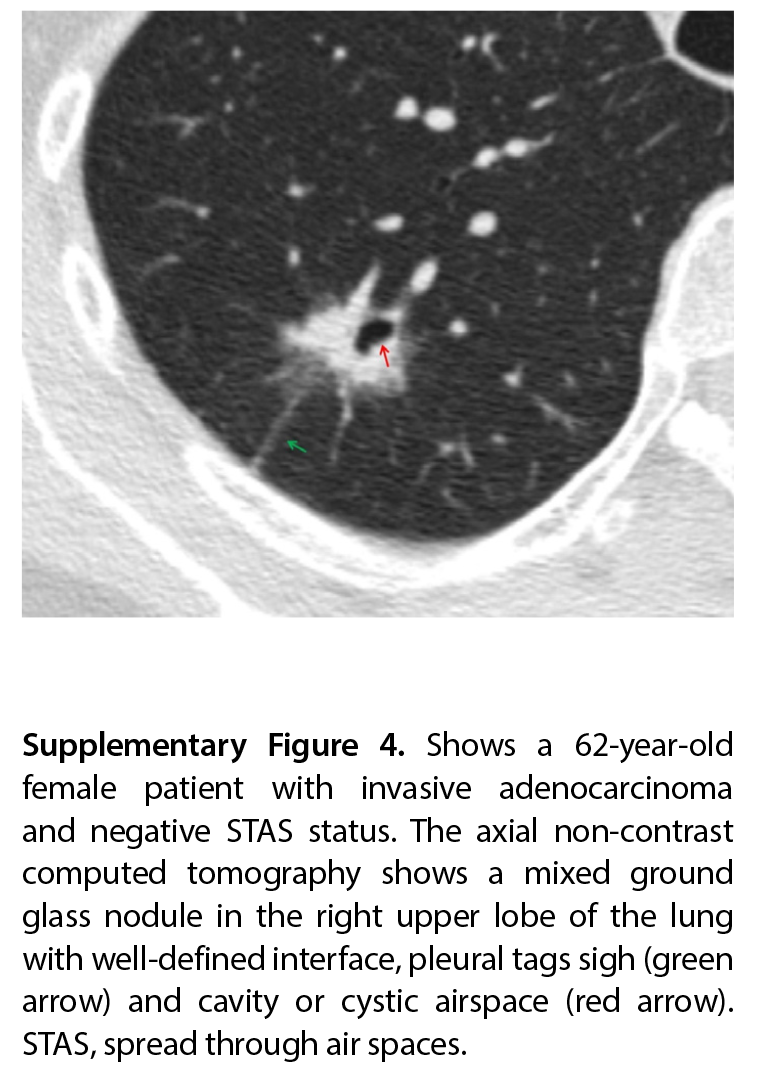 Supplementary Figure 4