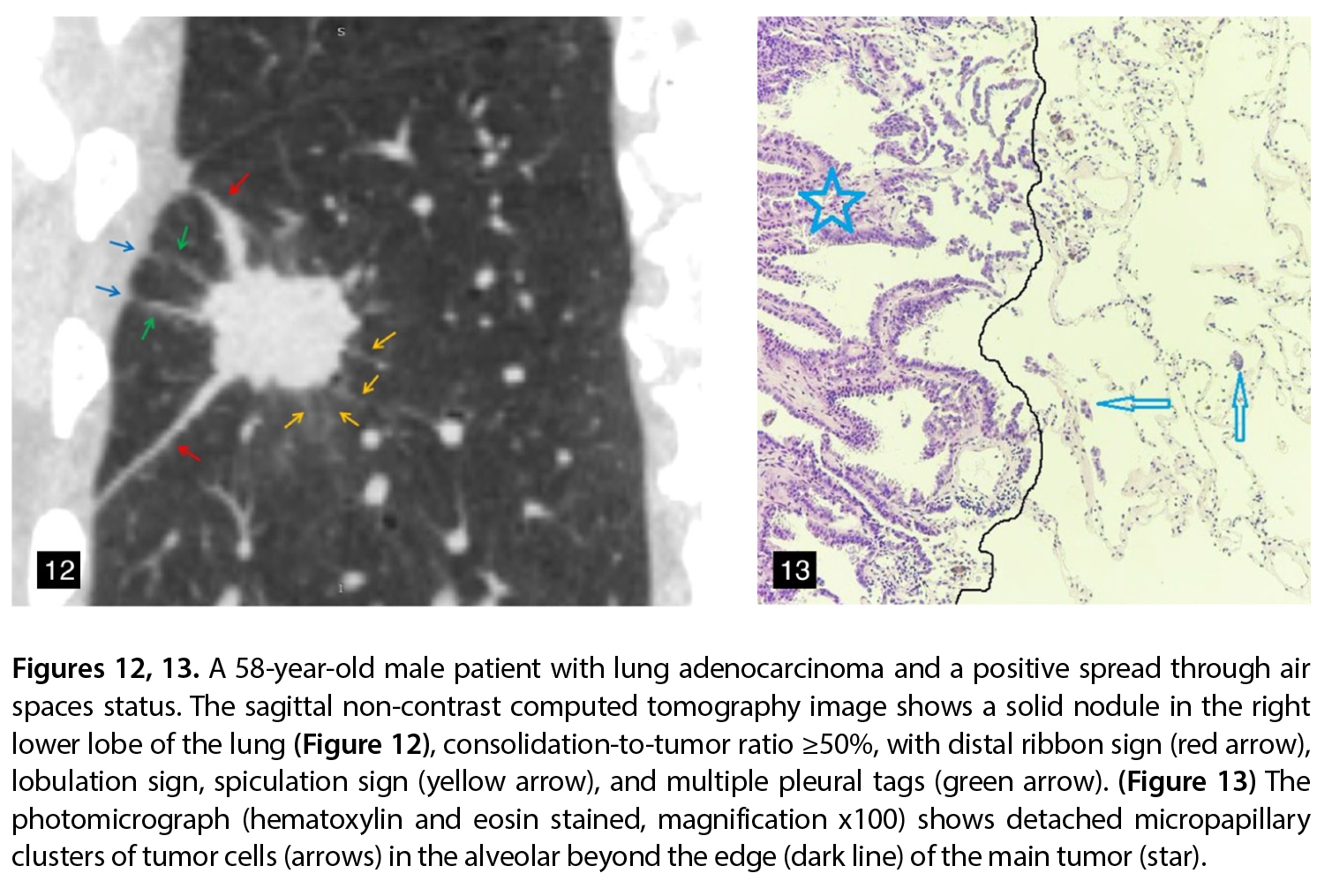 Figure 12-13