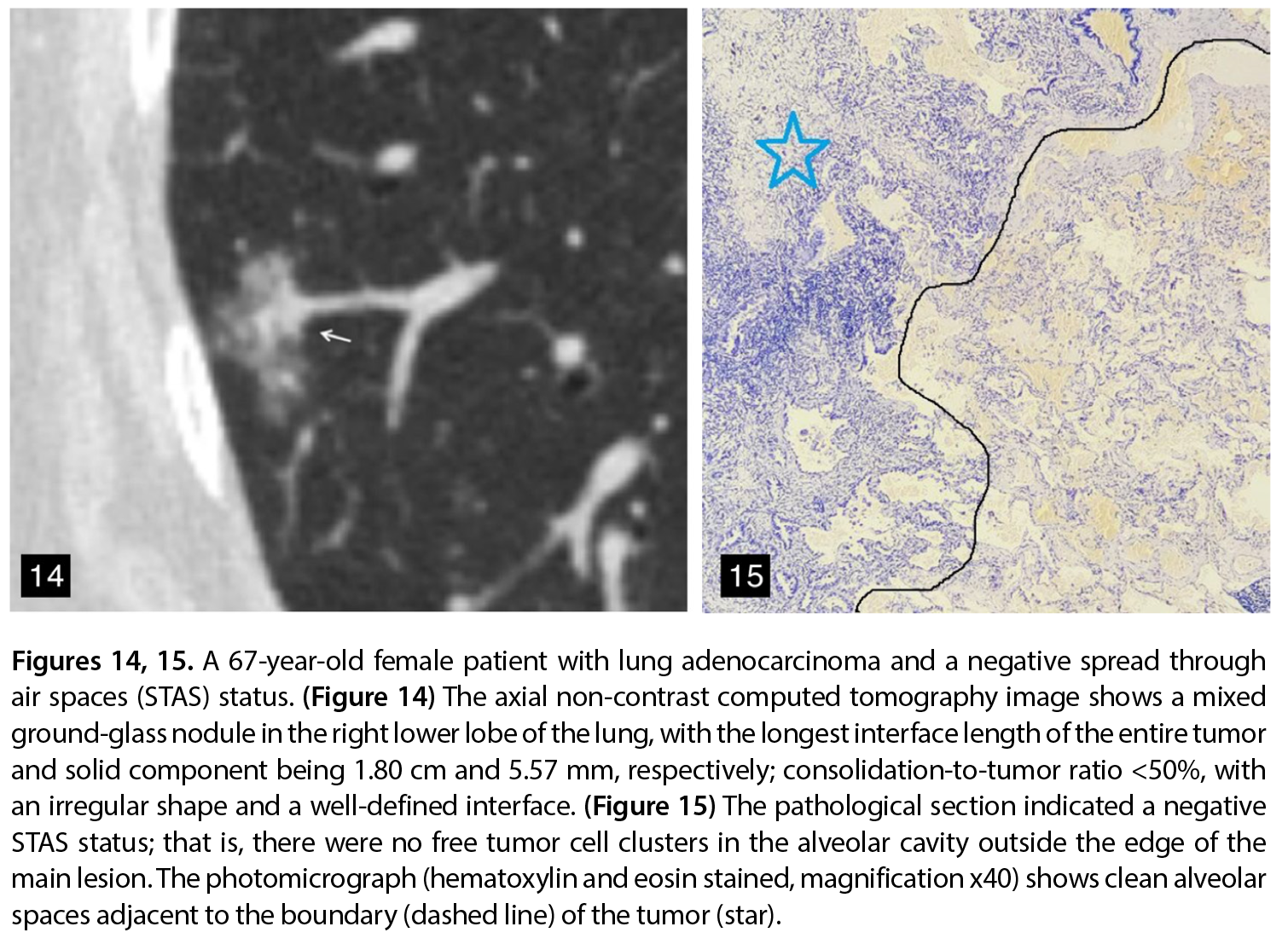 Figure 14-15