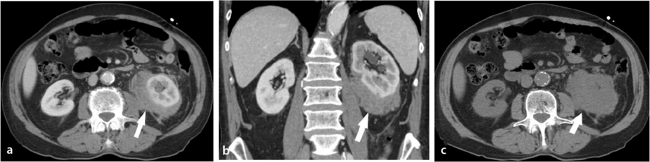 Figure 11