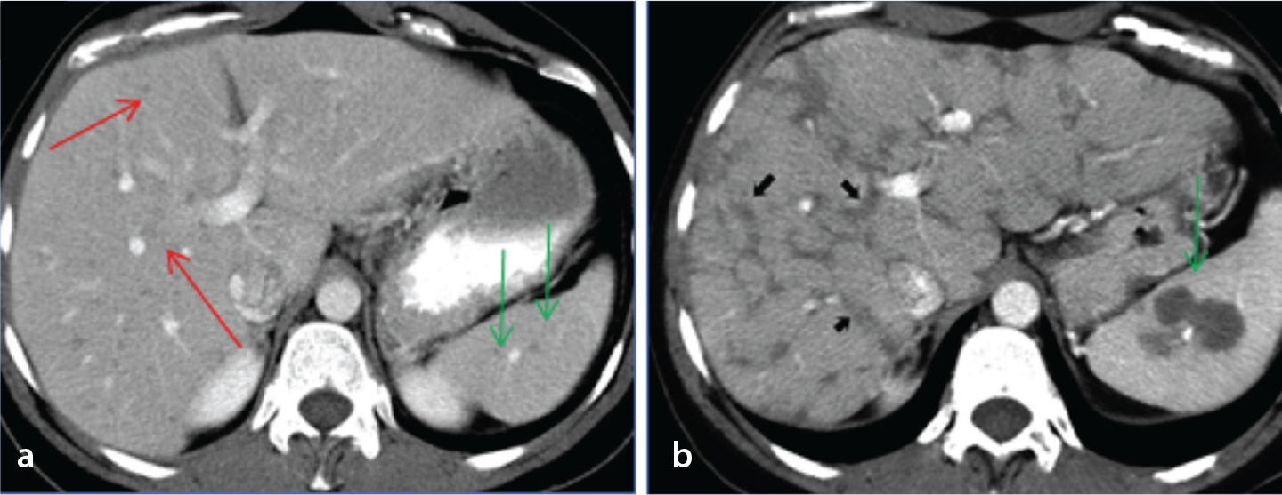Figure 11