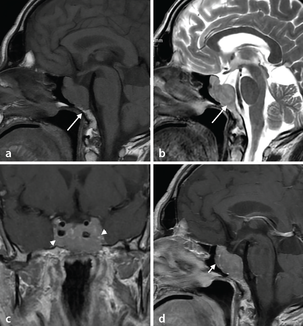 Figure 13
