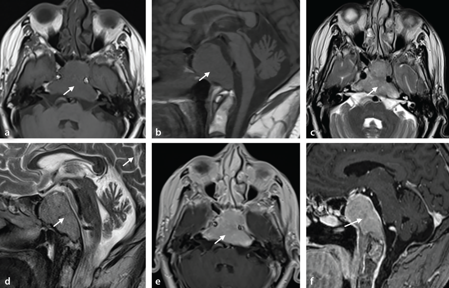 Figure 14