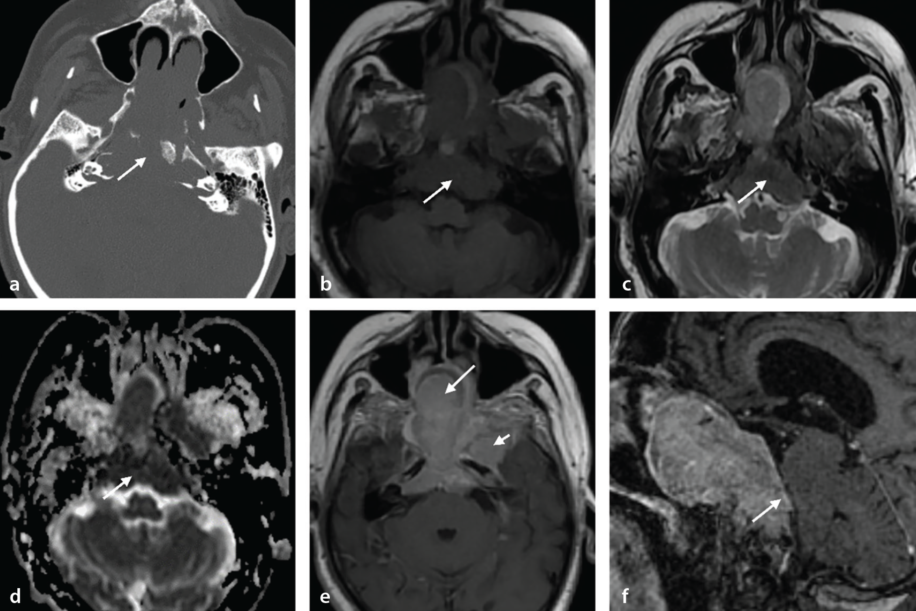 Figure 15