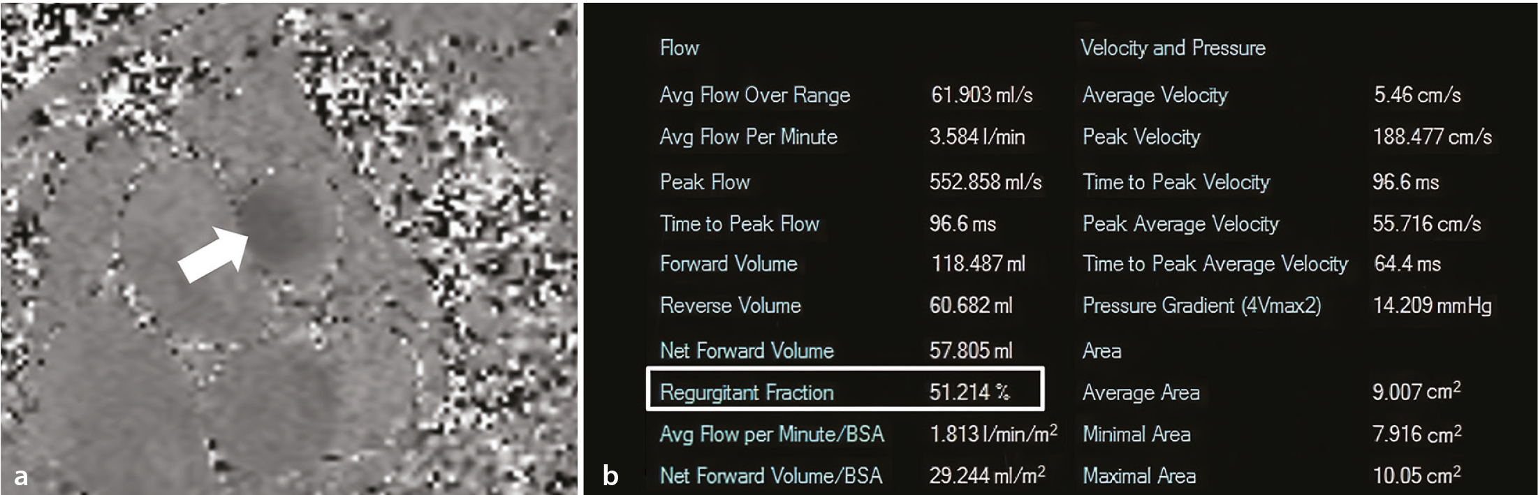 Figure 11