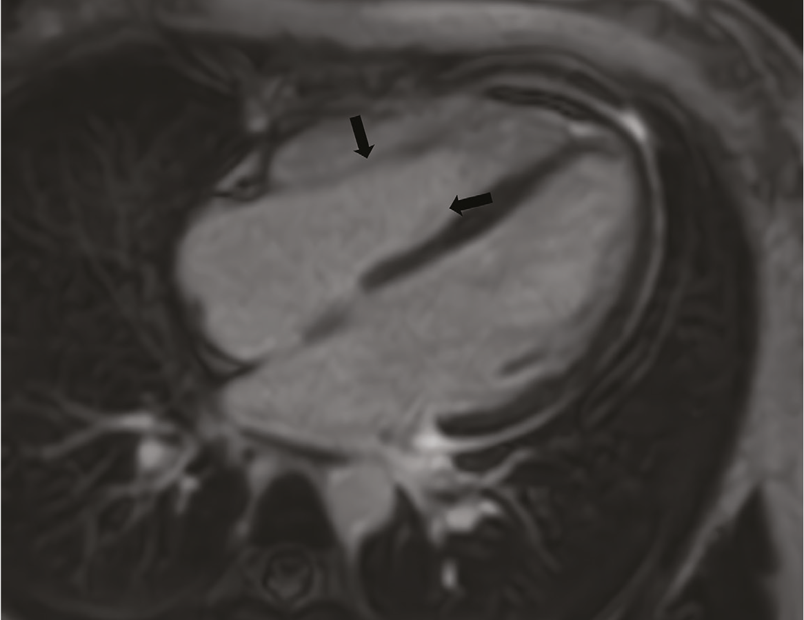 Figure 16