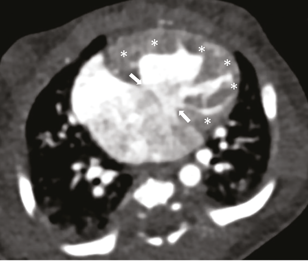 Figure 20