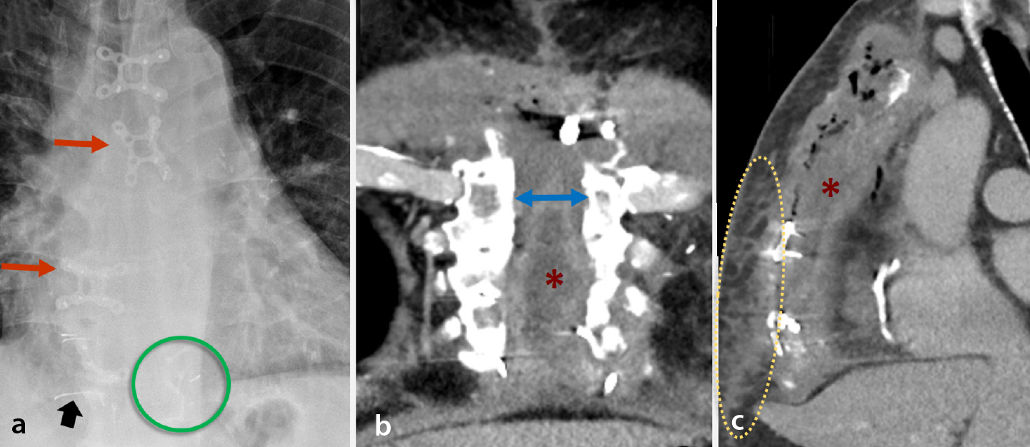 Figure 11