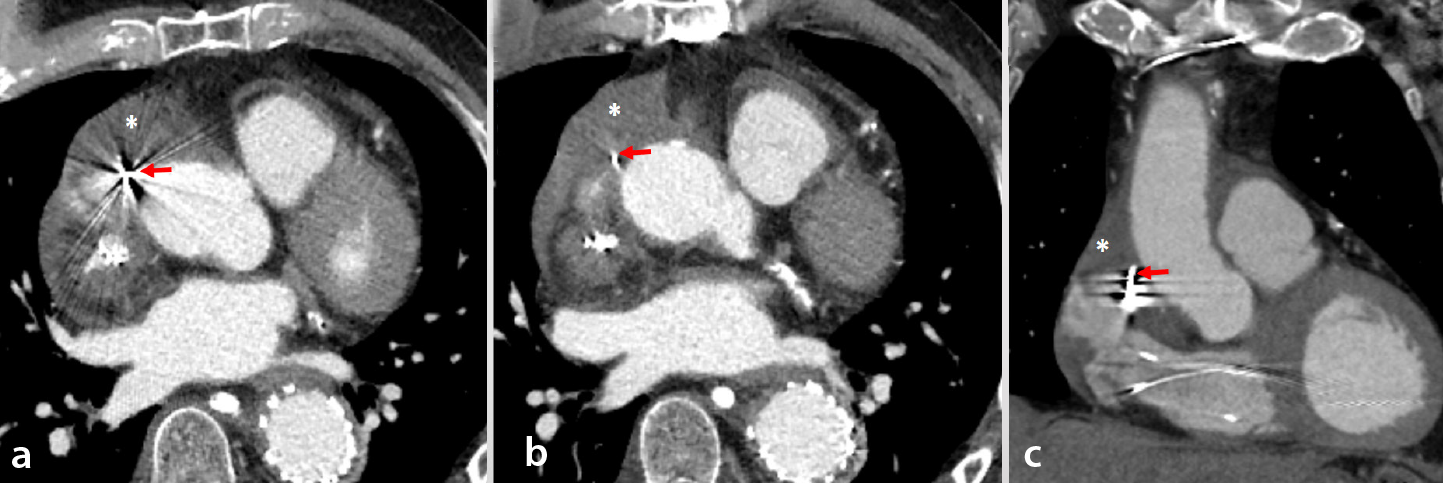 Figure 13