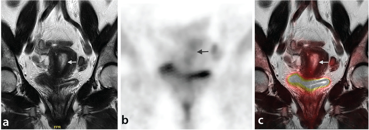 Figure 12