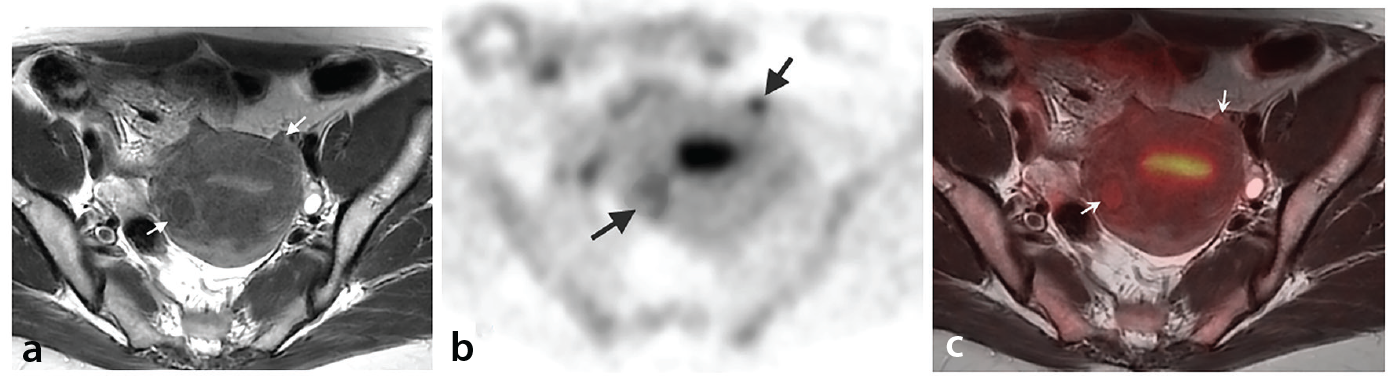 Figure 13